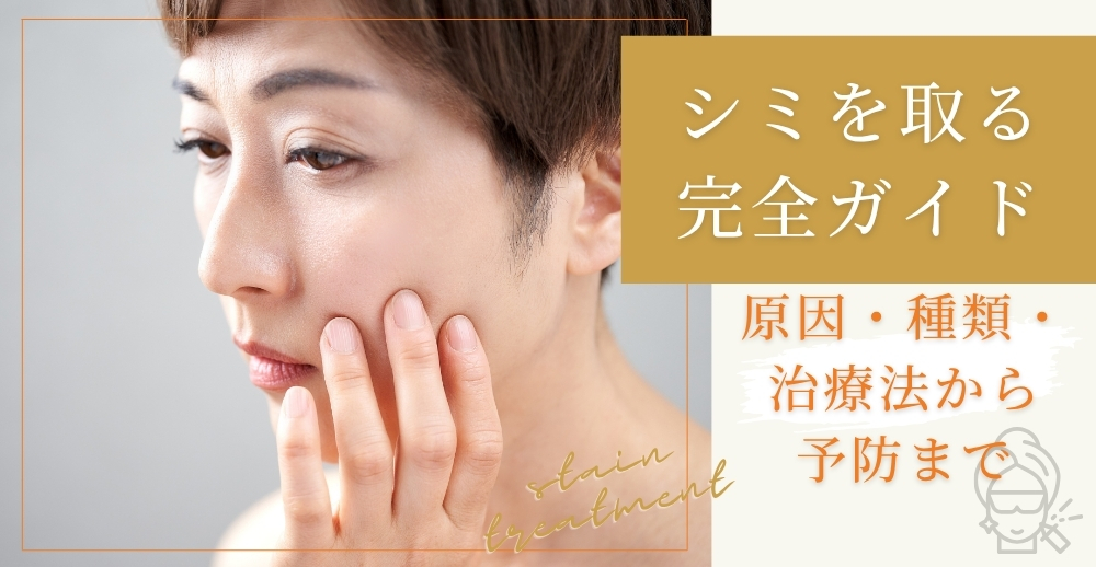 シミを取る完全ガイド：原因・種類・治療法から予防まで