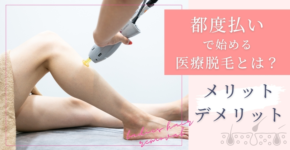 都度払いで始める医療脱毛とは？メリット・デメリット
