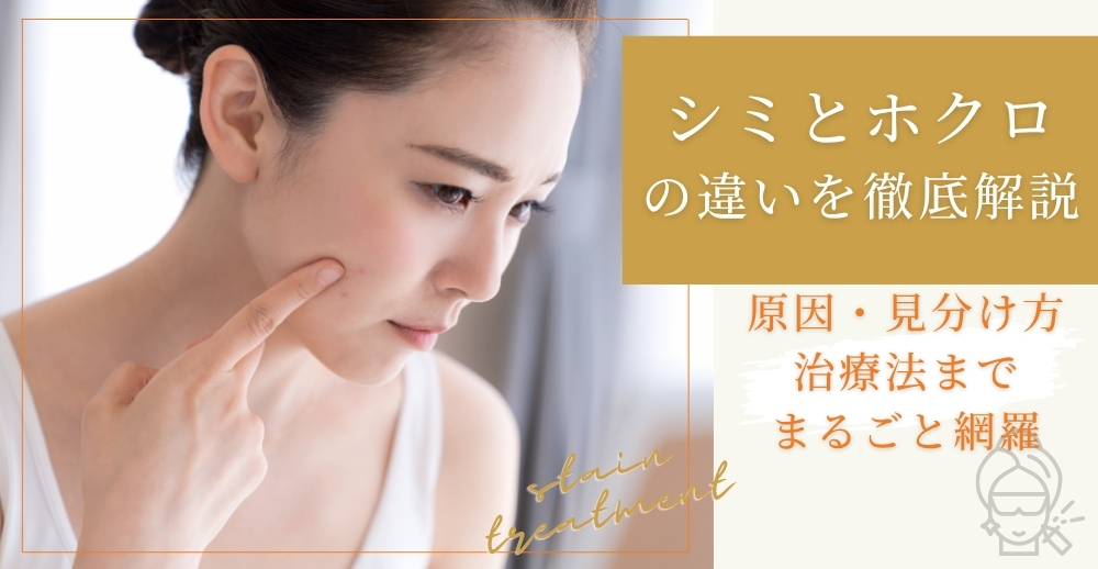 シミとホクロの違いを徹底解説：原因・見分け方・治療法までまるごと網羅