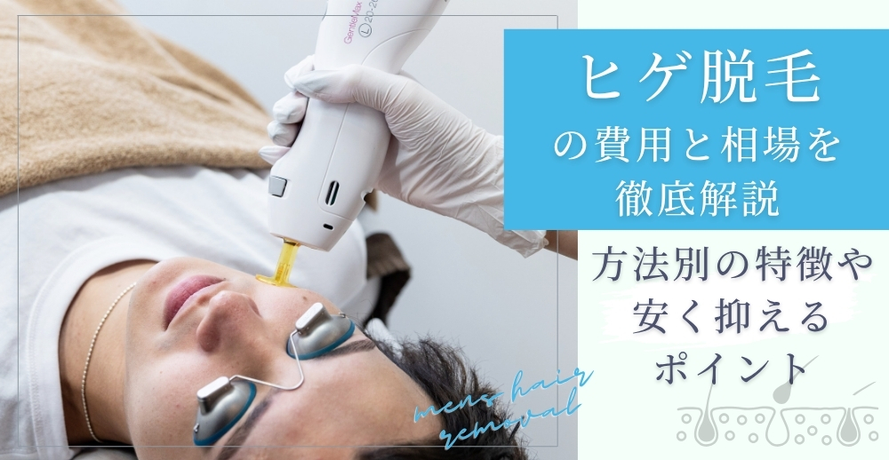 ヒゲ脱毛の費用と相場を徹底解説～方法別の特徴や安く抑えるポイント～