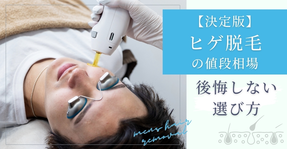 【決定版】ヒゲ脱毛の値段相場と後悔しない選び方