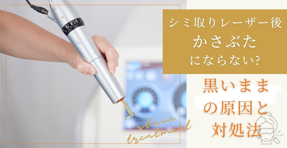 シミ取りレーザー後にかさぶたにならない・黒いままの原因と対処法を徹底解説