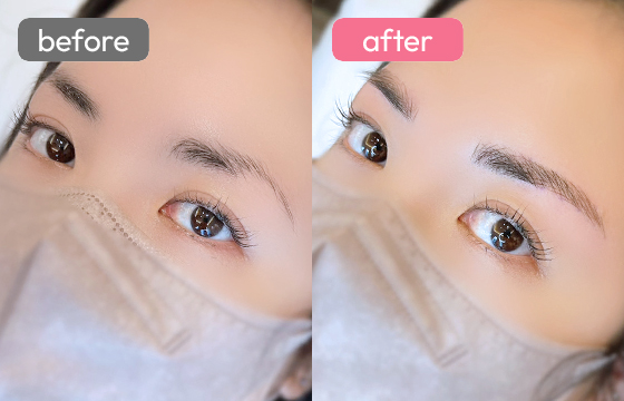 眉アートメイク-022 02