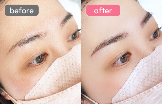 眉アートメイク-024