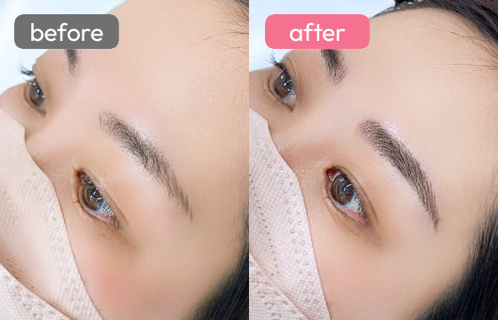 眉アートメイク-024 02