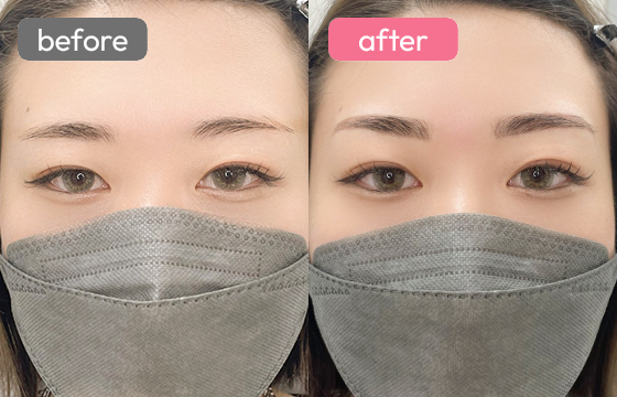 眉アートメイク-026