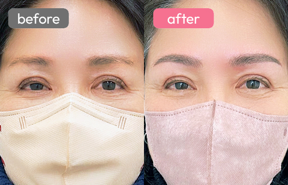 眉アートメイク-031 02