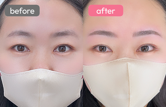 眉アートメイク-074 02