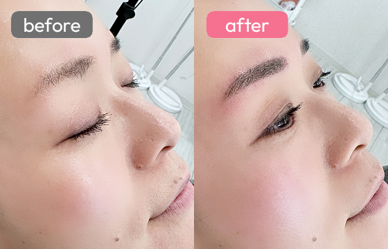 眉アートメイク-075 03