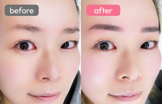 眉アートメイク-075