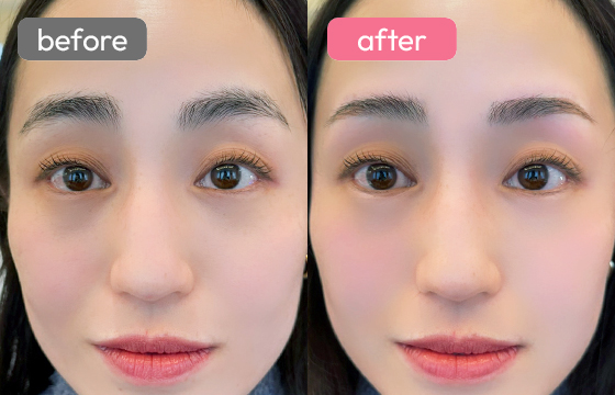 眉アートメイク-085