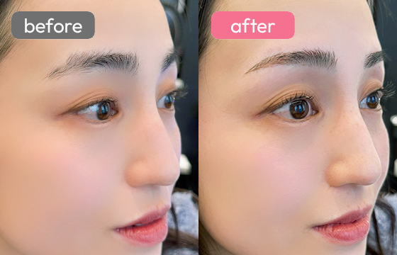 眉アートメイク-085 02