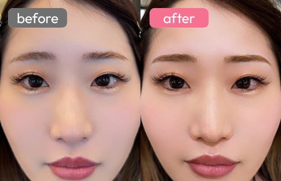 眉アートメイク-090 03