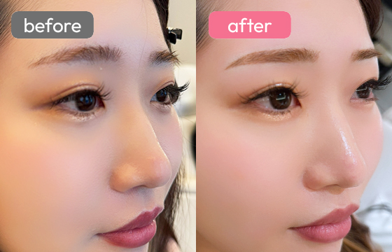 眉アートメイク-090