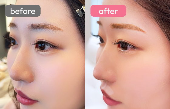 眉アートメイク-090 02