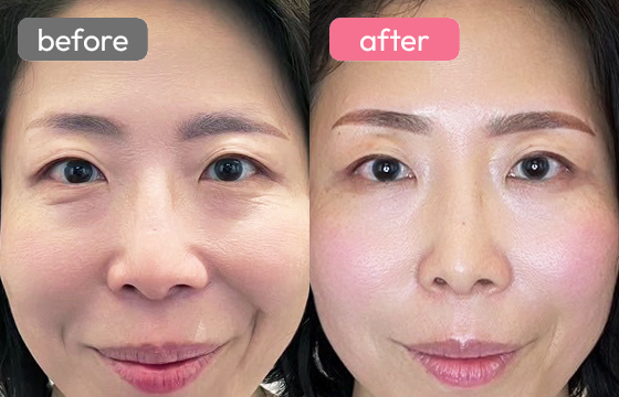 眉アートメイク-087 02