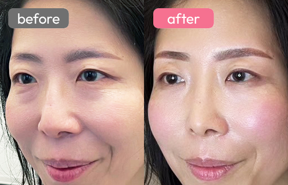 眉アートメイク-087