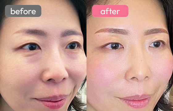 眉アートメイク-087 03