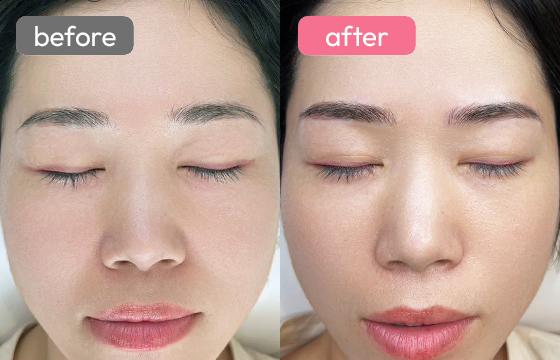 眉アートメイク-088 04