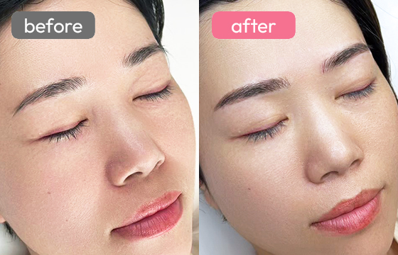 眉アートメイク-088 03