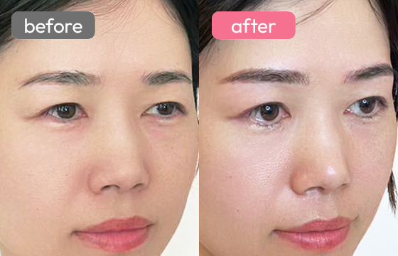 眉アートメイク-088