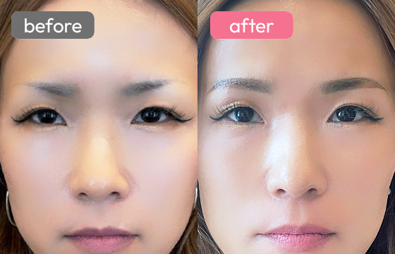 眉アートメイク-094