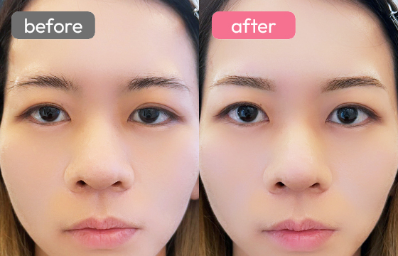 眉アートメイク-089