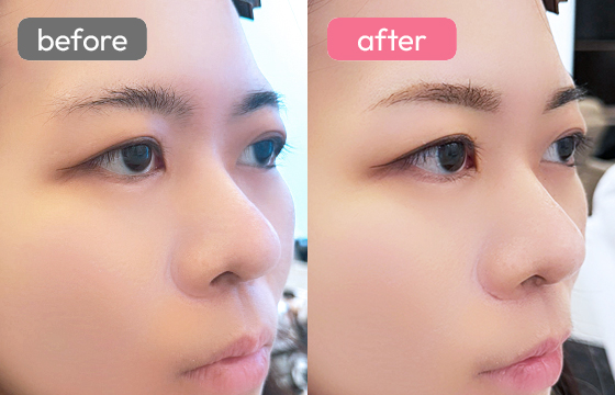 眉アートメイク-089 02