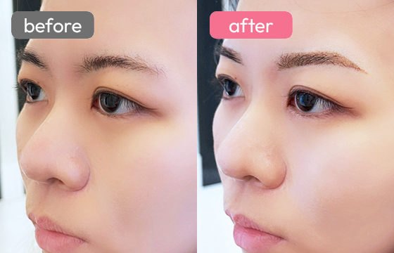 眉アートメイク-089 03