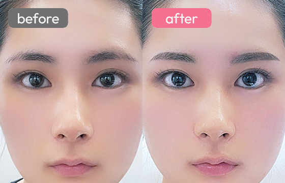 眉アートメイク-095