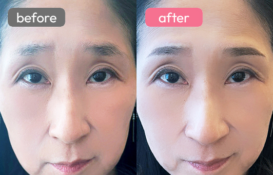 眉アートメイク-091 02