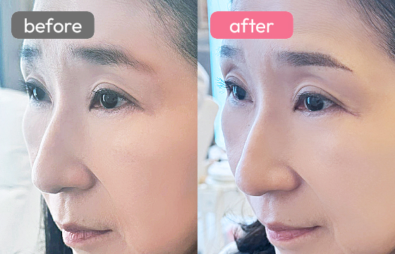 眉アートメイク-091 03