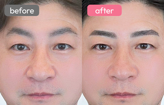 眉アートメイク(メンズ)04 02