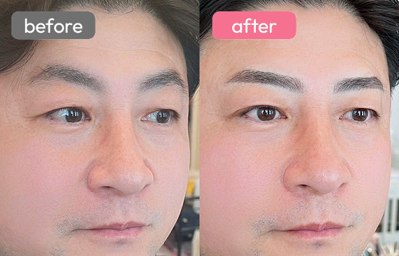 眉アートメイク(メンズ)04