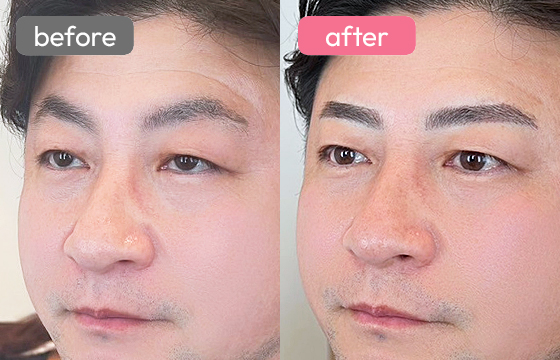 眉アートメイク(メンズ)04 03