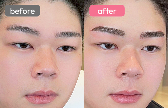 眉アートメイク(メンズ)05 02