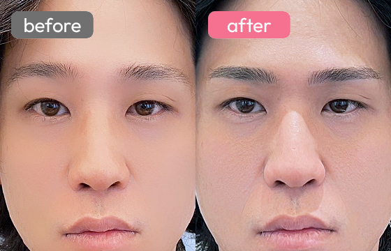 眉アートメイク(メンズ)07 02