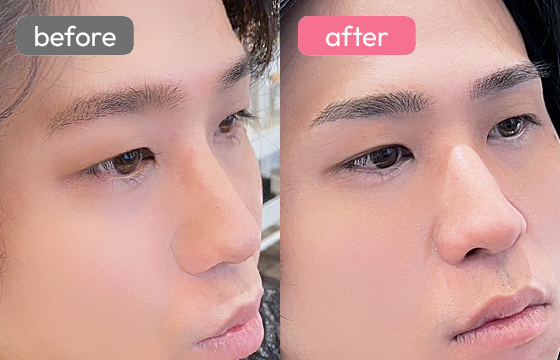 眉アートメイク(メンズ)07 03