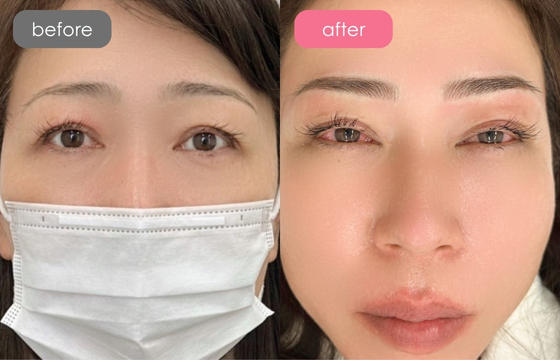 眉アートメイク-099