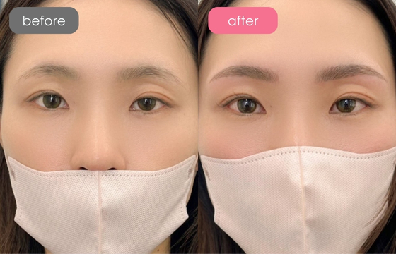 眉アートメイク-100 02