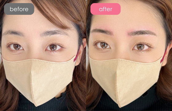 眉アートメイク-101 03