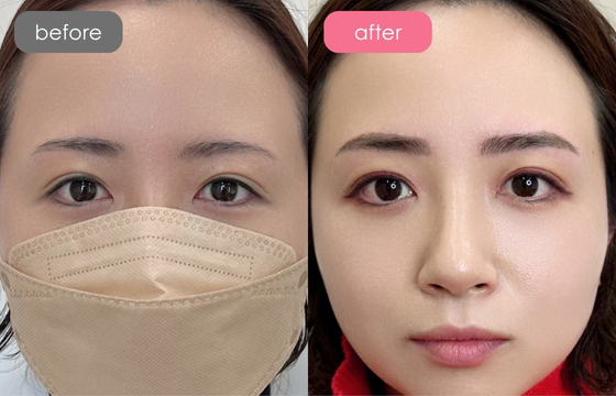 眉アートメイク-102