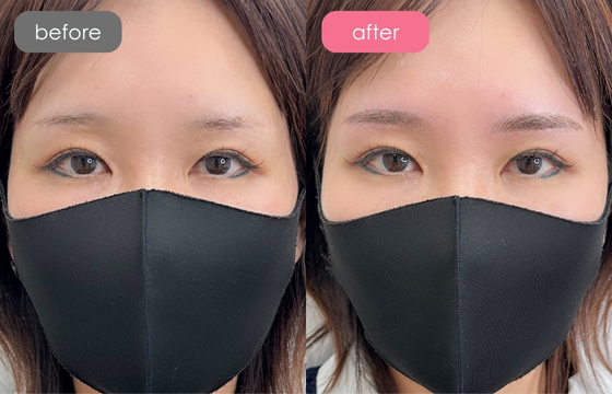 眉アートメイク-103