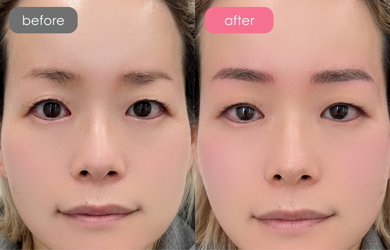 眉アートメイク-105 03