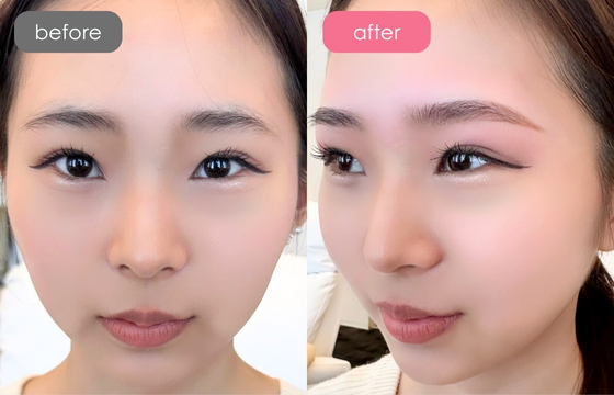 眉アートメイク-092 02