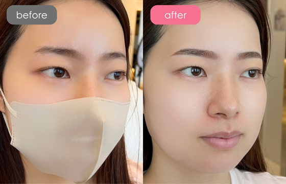 眉アートメイク-112 02