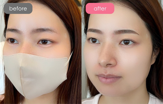 眉アートメイク-112 03