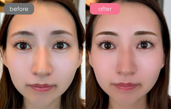 眉アートメイク-113 03