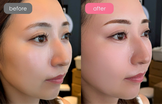 眉アートメイク-113 02