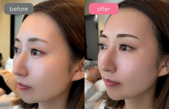 眉アートメイク-113